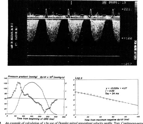 The Time Constant of Left Ventricular Relaxation: